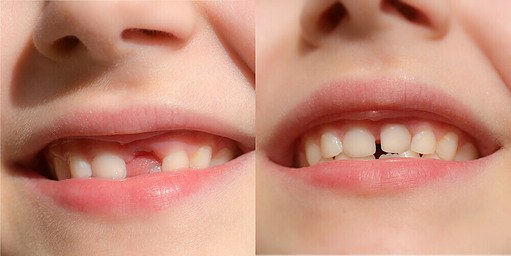 Dental Emergency Treatment