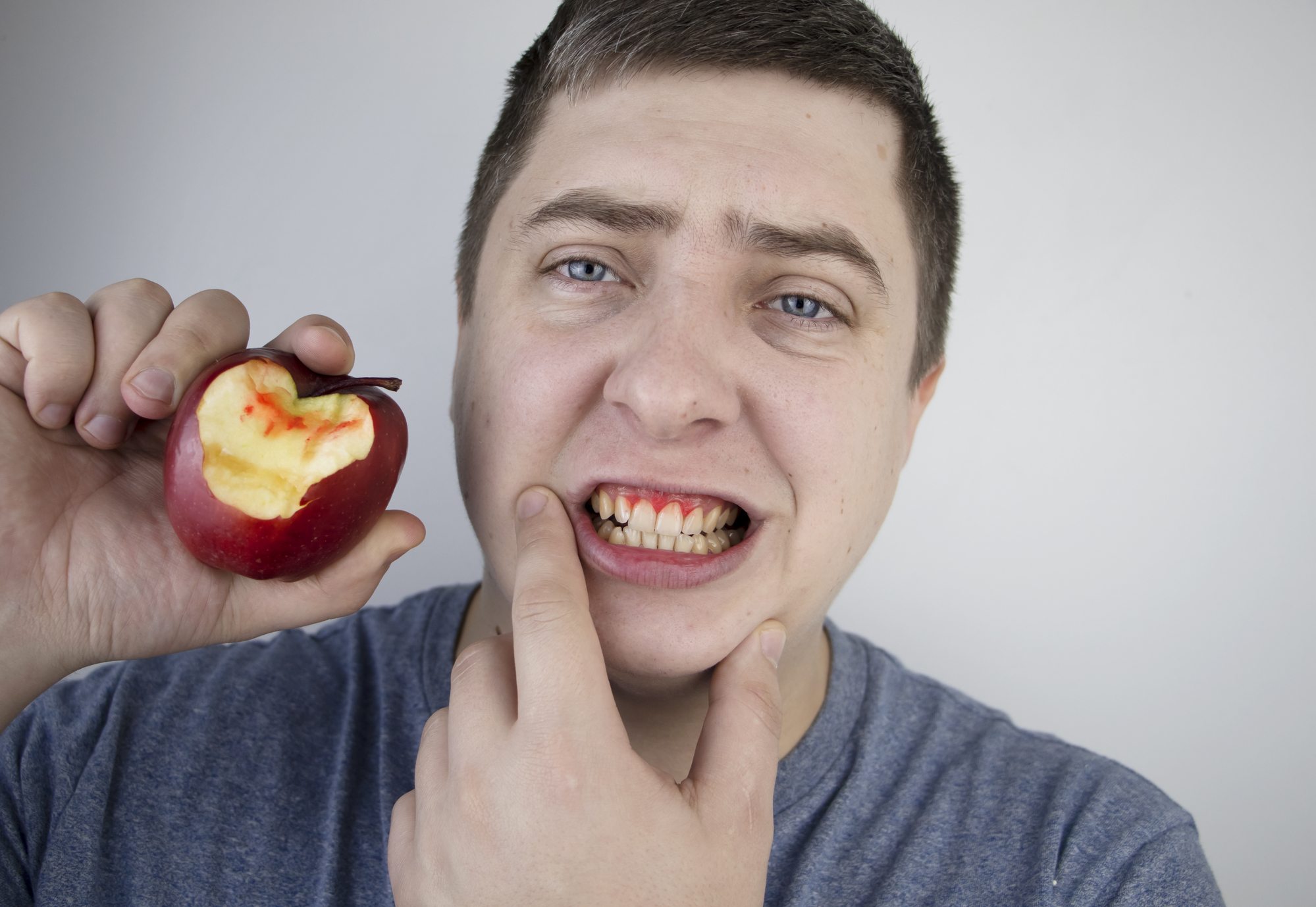 Bleeding Gums