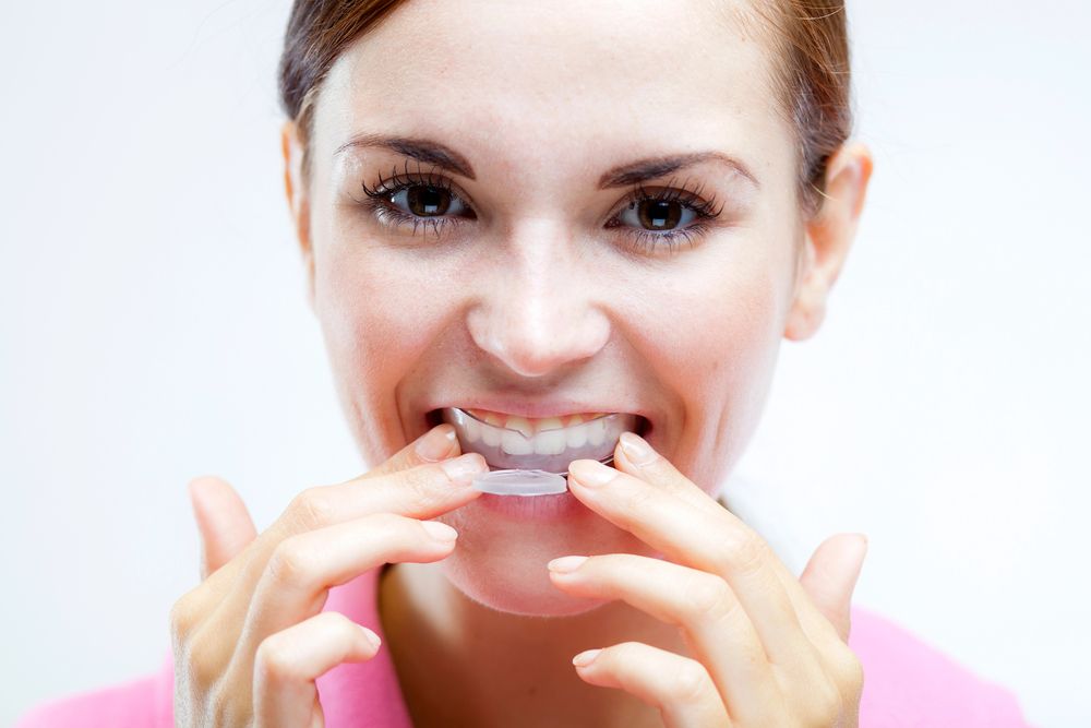 Teeth whitening methods