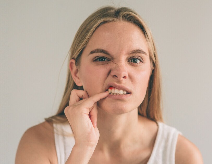 bleeding after brushing or flossing_red gums_swollen gums_pain at the gum line_gum disease treatment_dental pain_heal gum teeth