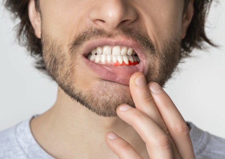 Pain At The Gum Line